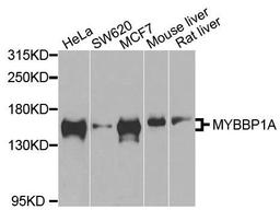 Western blot analysis of extracts of various cells using MYBBP1A antibody