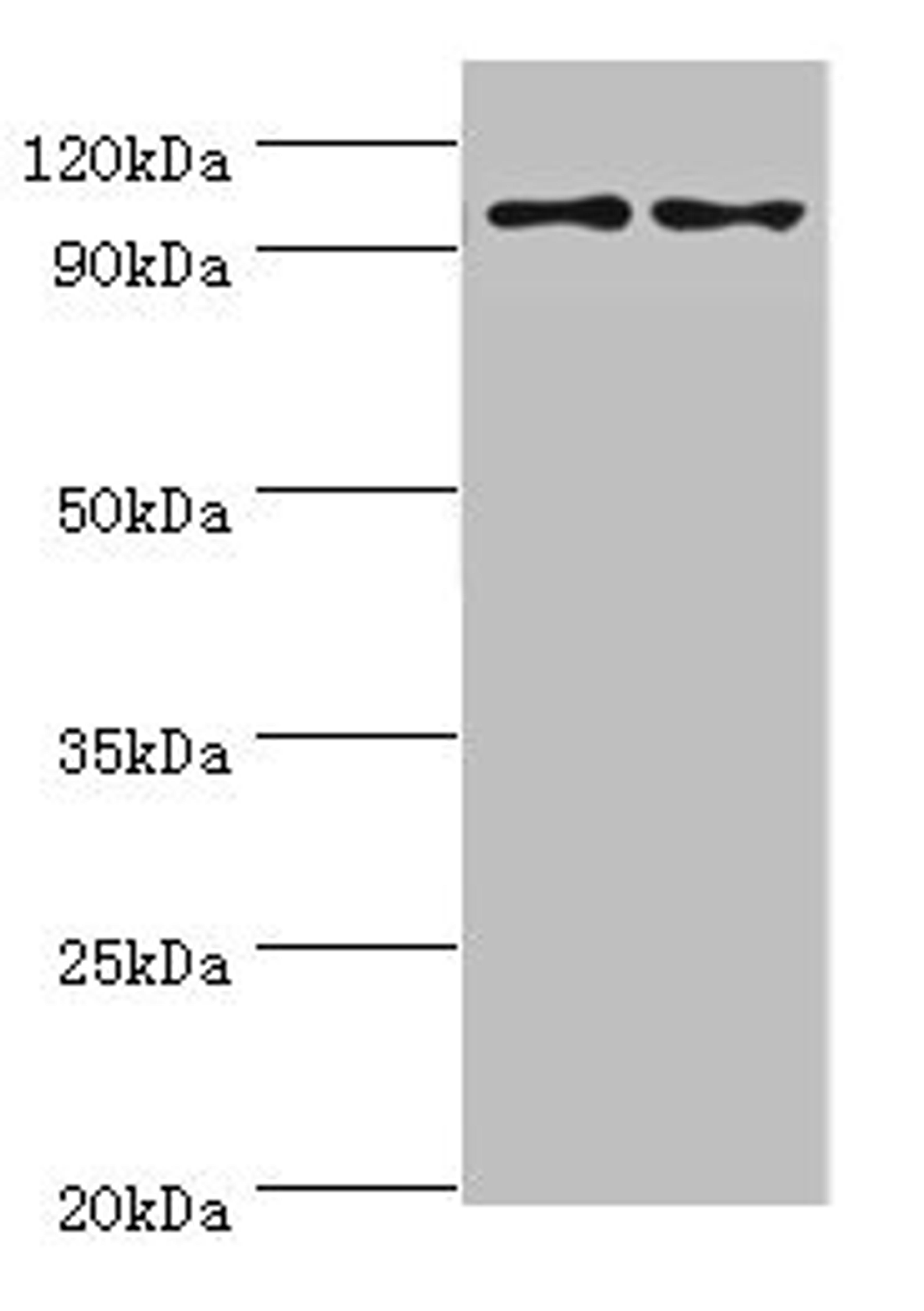 Western blot. All lanes: NLGN4Y antibody at 6ug/ml. Lane 1: A549 whole cell lysate. Lane 2: Mouse brain tissue. Secondary. Goat polyclonal to rabbit IgG at 1/10000 dilution. Predicted band size: 93, 73, 16, 29 kDa. Observed band size: 93 kDa. 