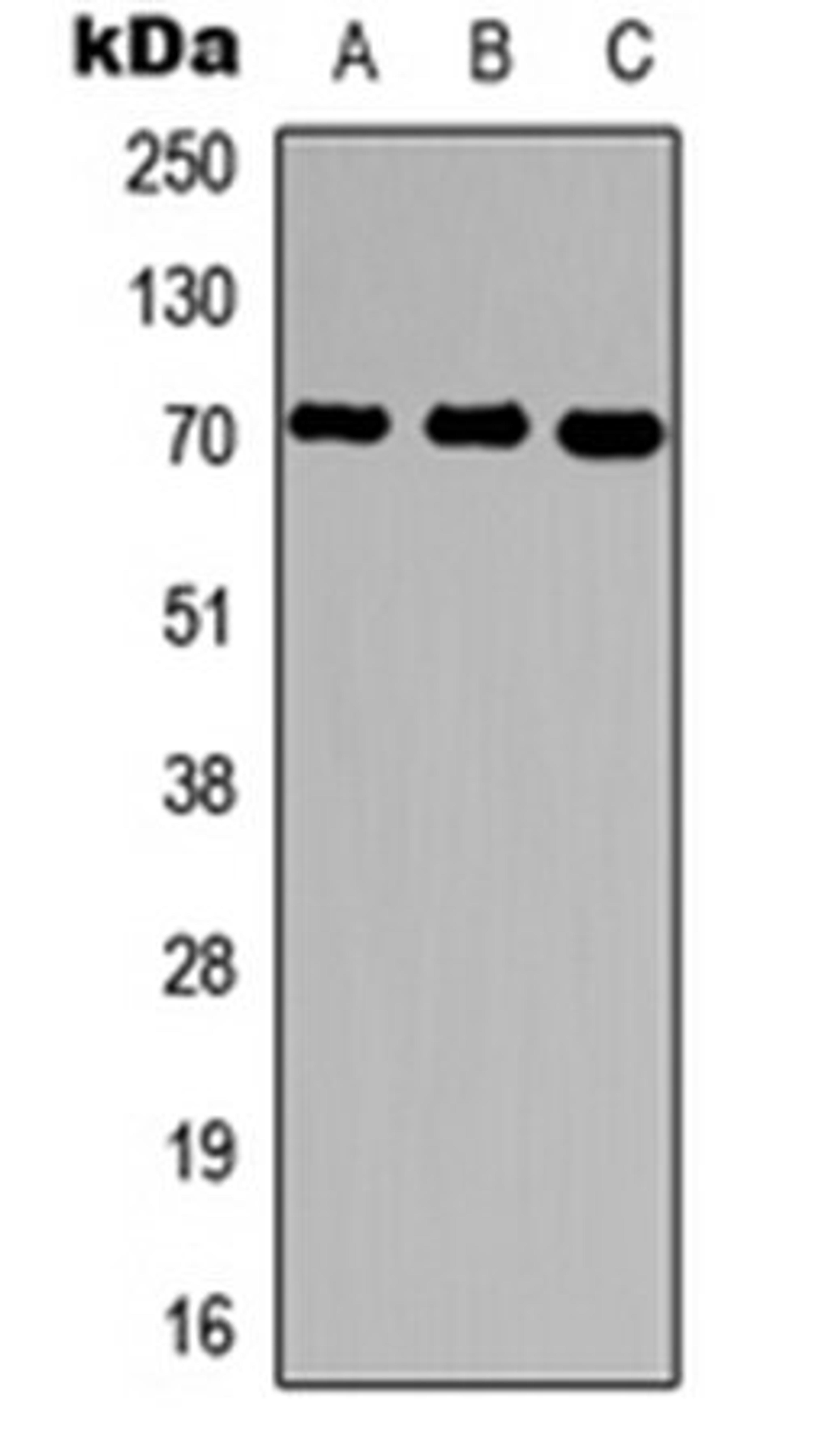 Western blot analysis of HepG2 (Lane 1), rat brain (Lane 2), rat liver (Lane 3) whole cell lysates using Ubiquilin 3 antibody