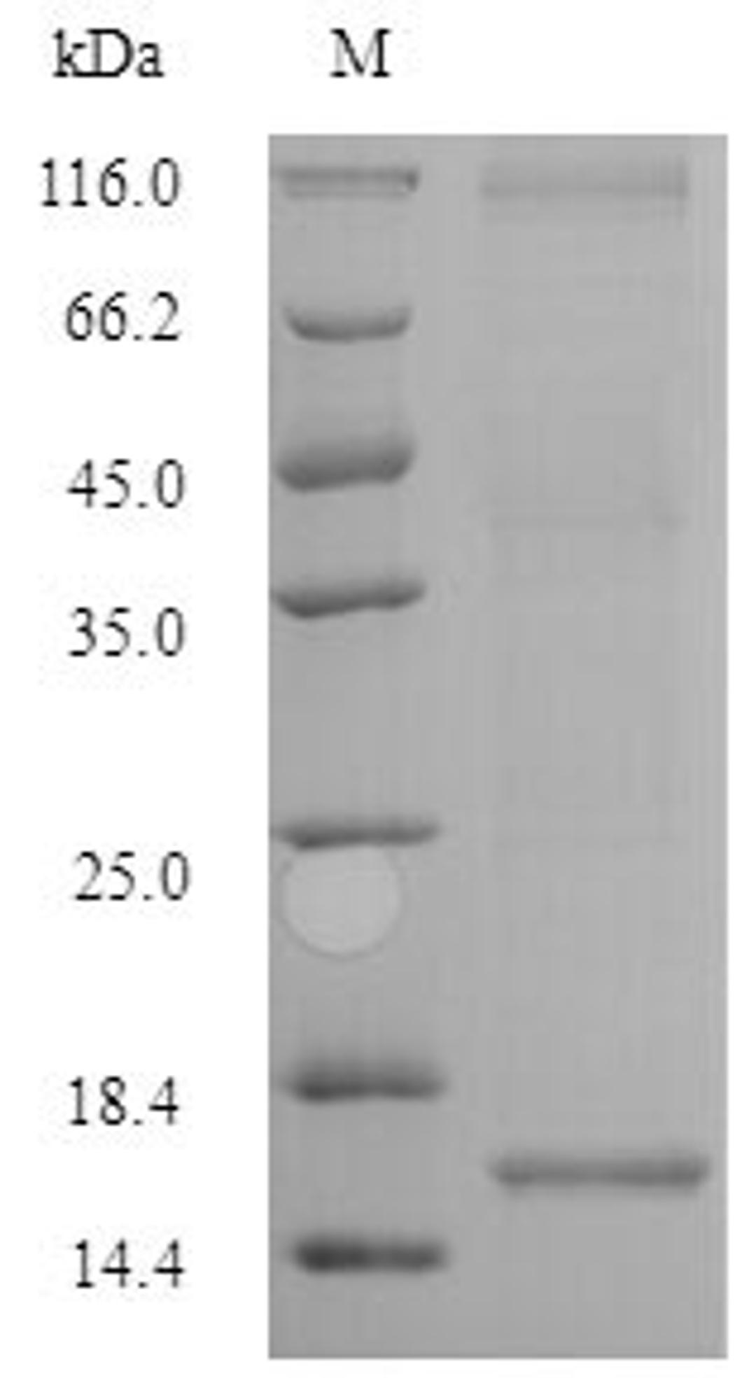 (Tris-Glycine gel) Discontinuous SDS-PAGE (reduced) with 5% enrichment gel and 15% separation gel.
