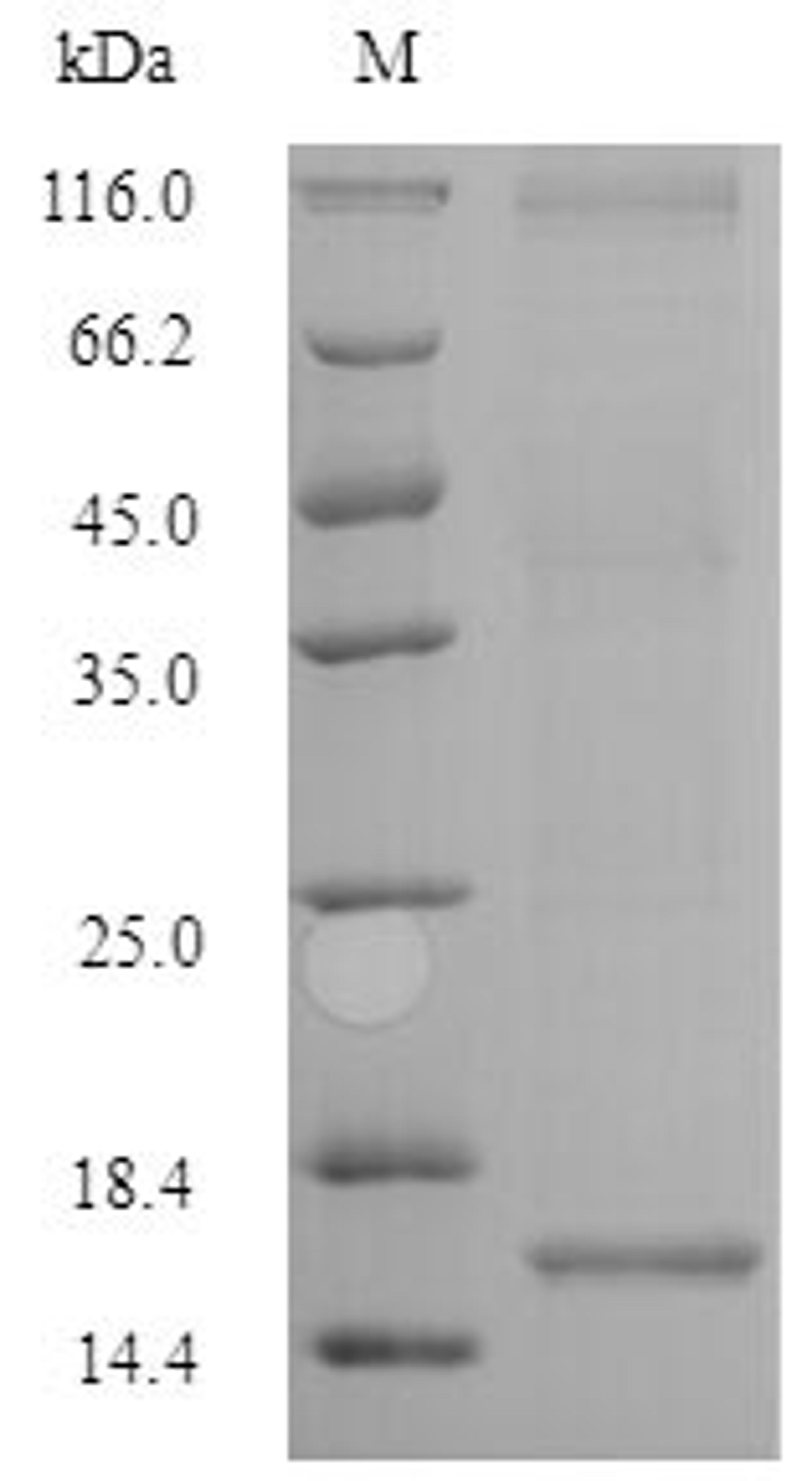 (Tris-Glycine gel) Discontinuous SDS-PAGE (reduced) with 5% enrichment gel and 15% separation gel.