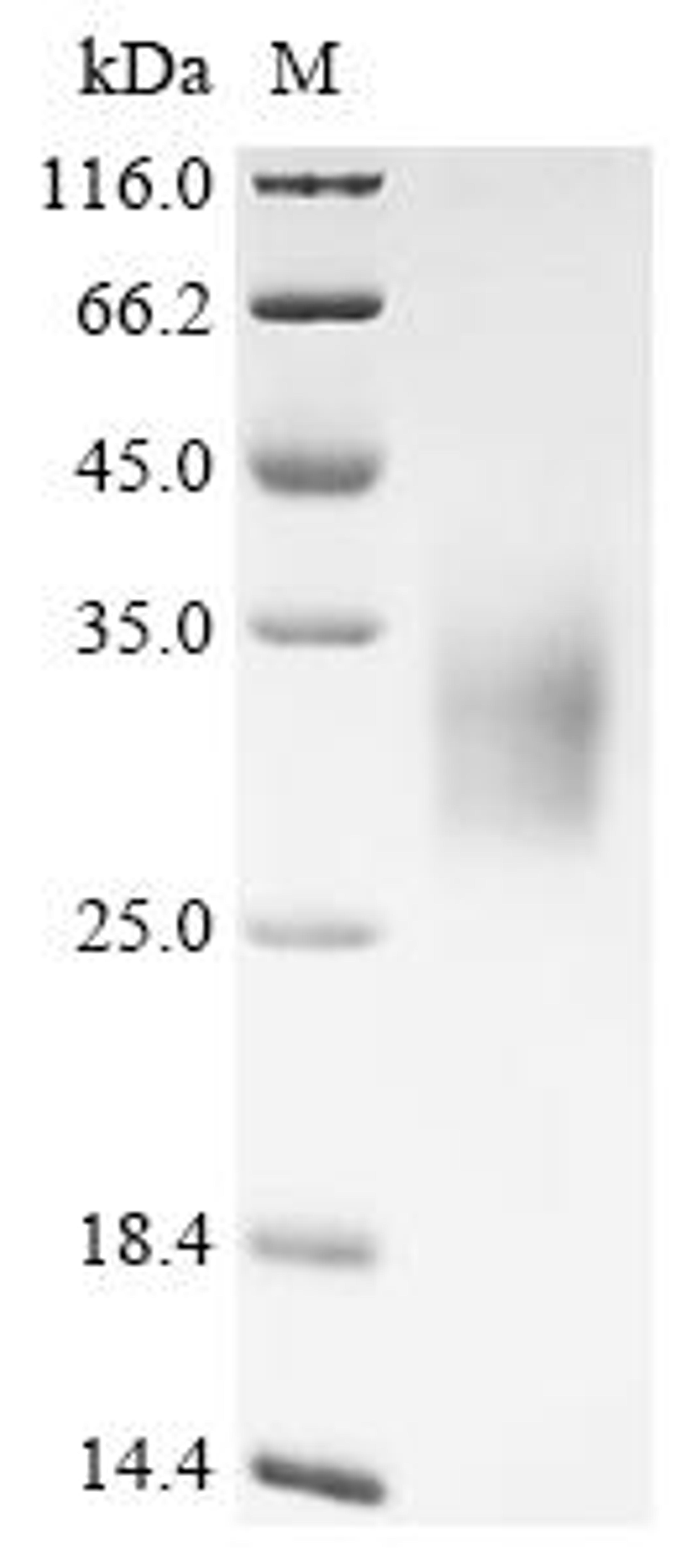 (Tris-Glycine gel) Discontinuous SDS-PAGE (reduced) with 5% enrichment gel and 15% separation gel.