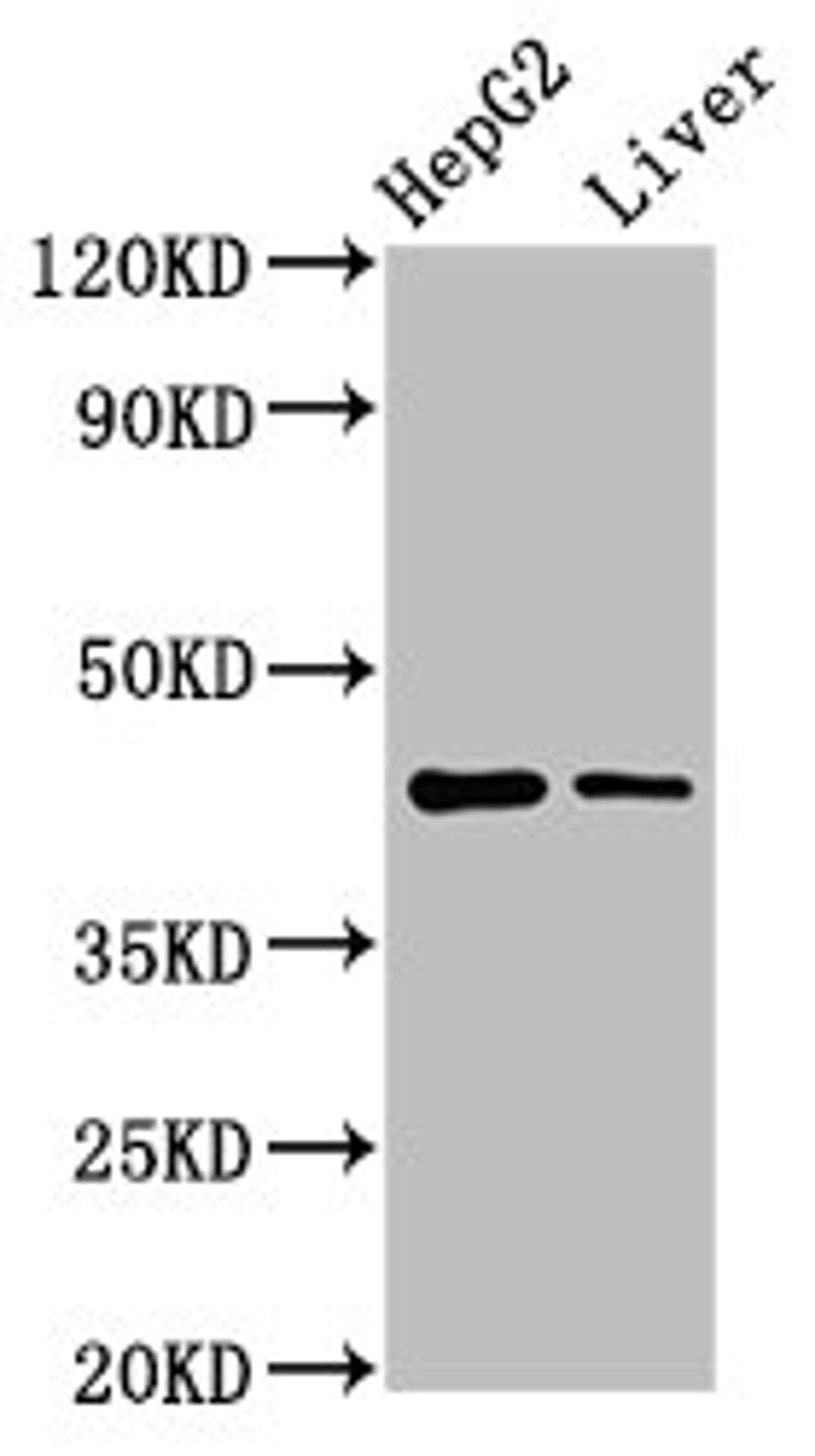 Western Blot. Positive WB detected in: HepG2 whole cell lysate, Rat liver tissue. All lanes: MVD antibody at 7.4µg/ml. Secondary. Goat polyclonal to rabbit IgG at 1/50000 dilution. Predicted band size: 44 kDa. Observed band size: 44 kDa