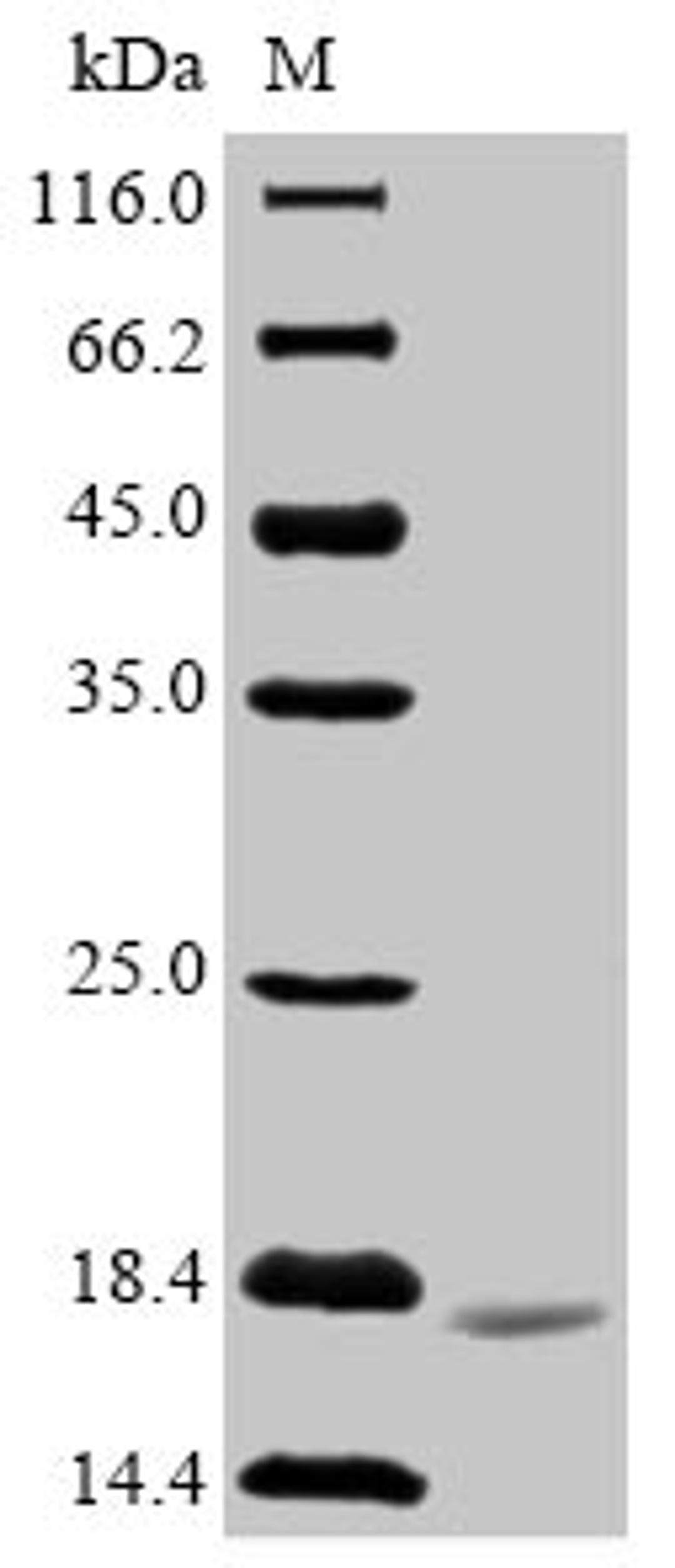 (Tris-Glycine gel) Discontinuous SDS-PAGE (reduced) with 5% enrichment gel and 15% separation gel.