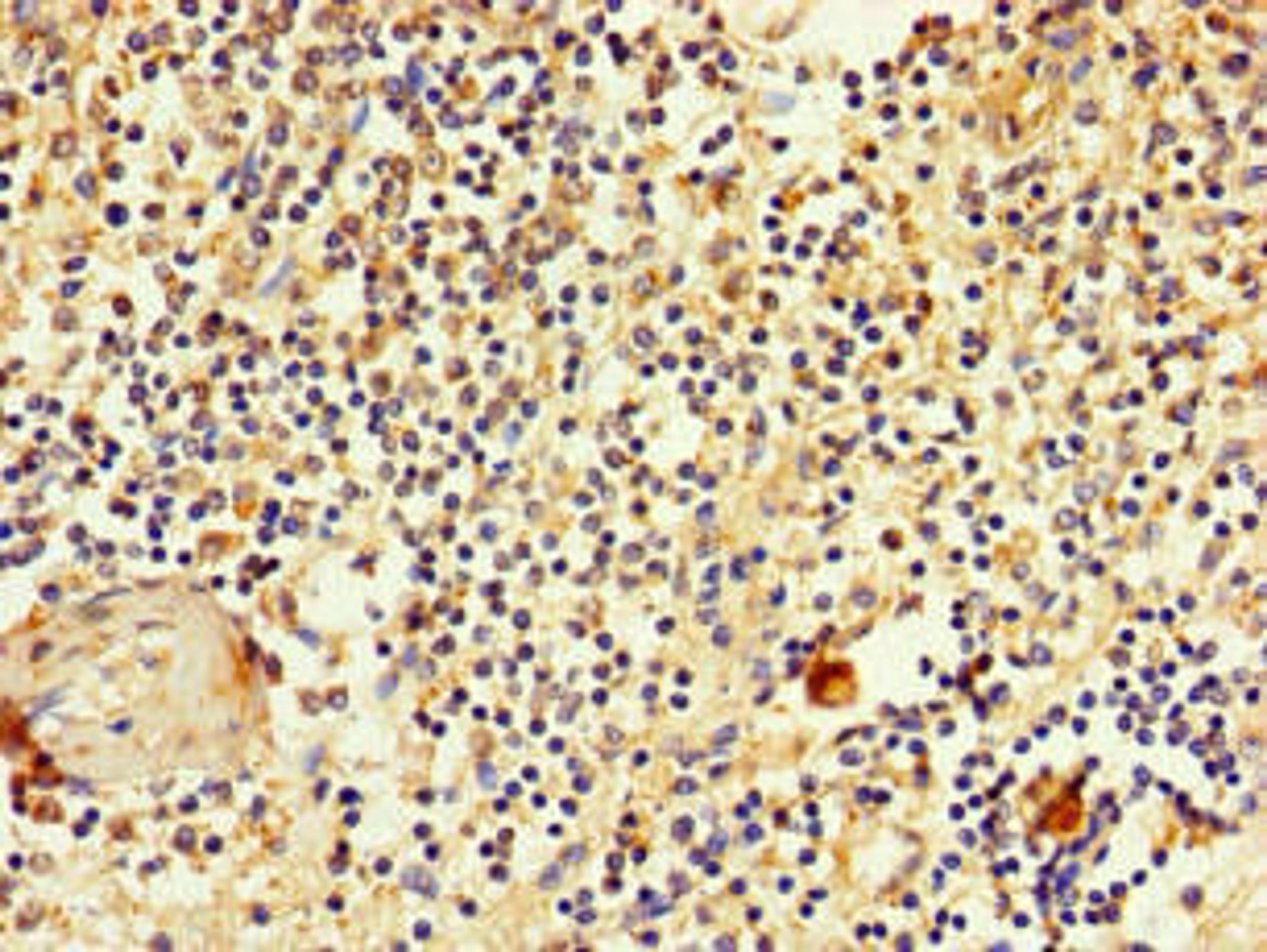 Immunohistochemistry of paraffin-embedded human spleen tissue using CSB-PA021553LA01HU at dilution of 1:100