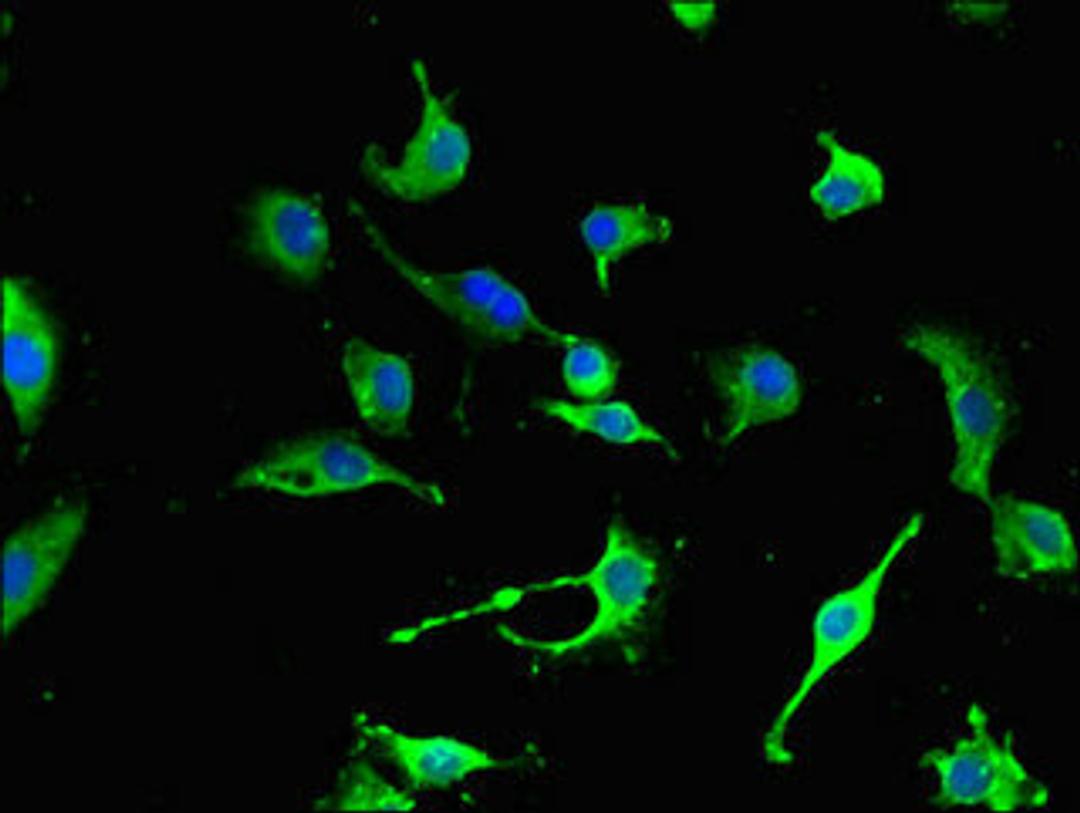 Immunofluorescent analysis of U251 cells using CSB-PA015713YA01HU at dilution of 1:100 and Alexa Fluor 488-congugated AffiniPure Goat Anti-Rabbit IgG(H+L)