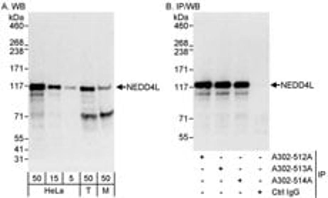 Detection of human and mouse NEDD4L by western blot (h&m) and immunoprecipitation (h).