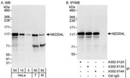 Detection of human and mouse NEDD4L by western blot (h&m) and immunoprecipitation (h).