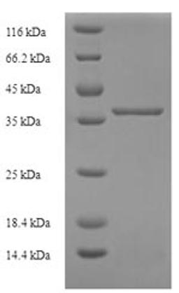 (Tris-Glycine gel) Discontinuous SDS-PAGE (reduced) with 5% enrichment gel and 15% separation gel.