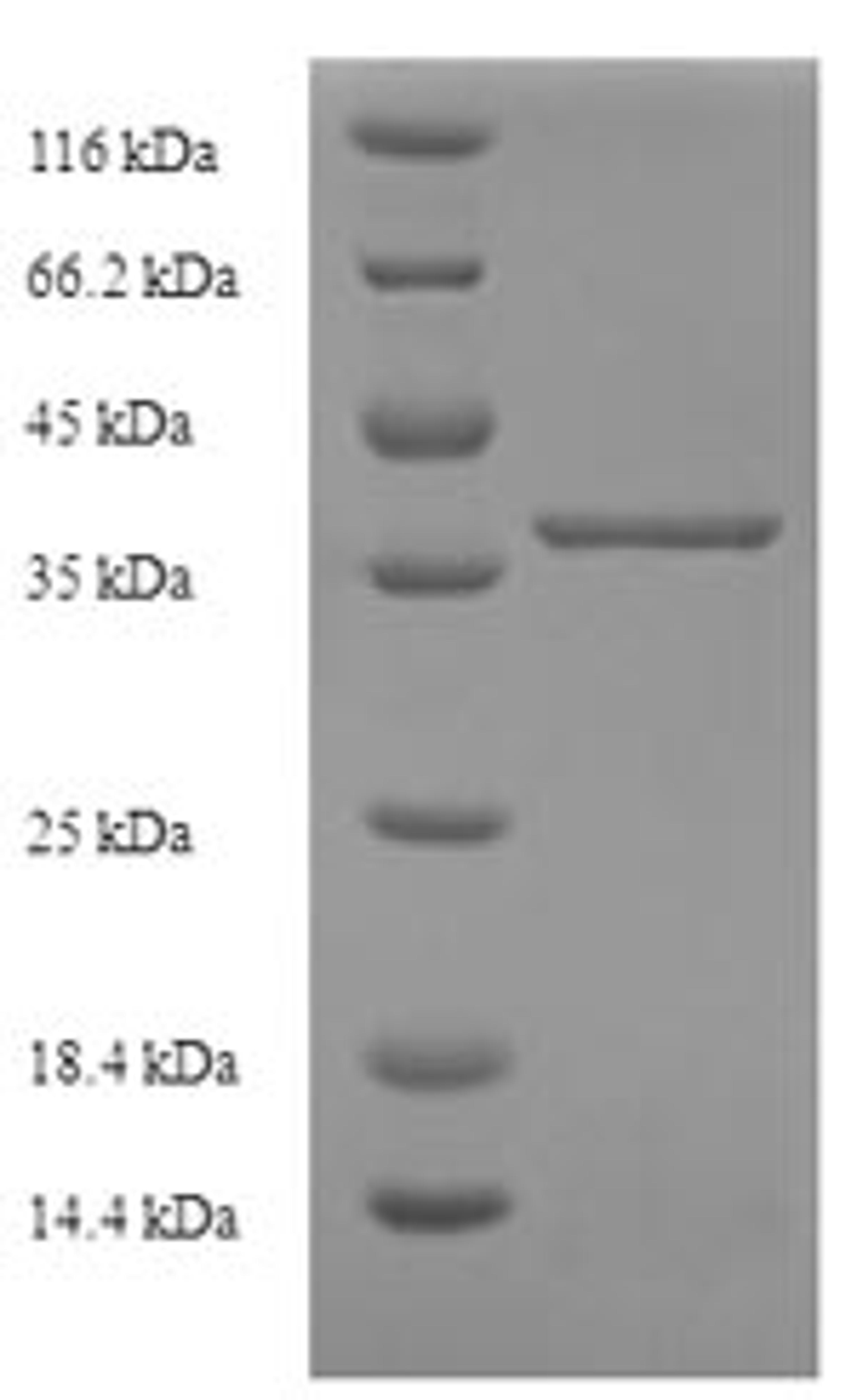 (Tris-Glycine gel) Discontinuous SDS-PAGE (reduced) with 5% enrichment gel and 15% separation gel.