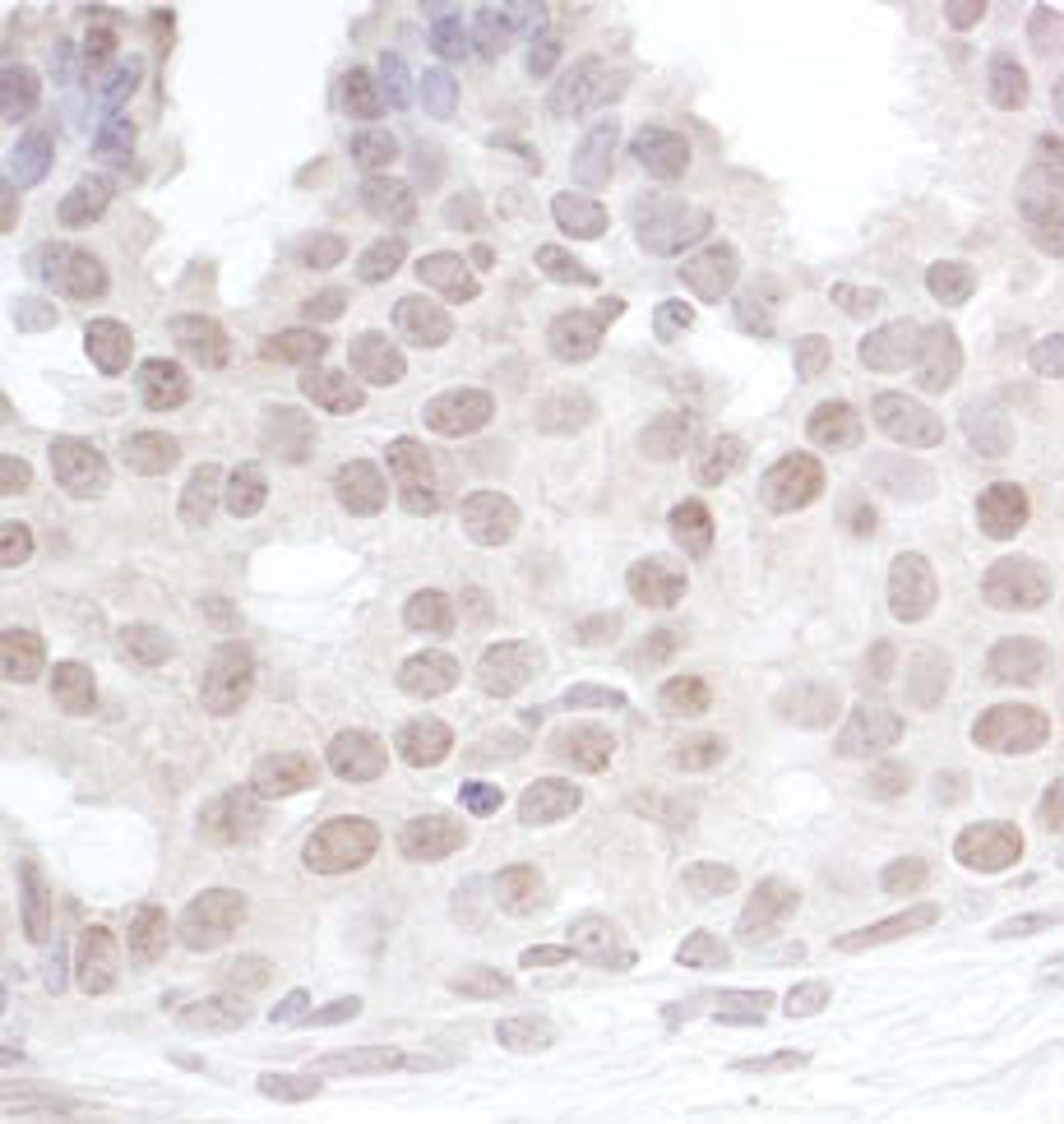 Detection of human Gemin4 by immunohistochemistry.