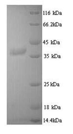 (Tris-Glycine gel) Discontinuous SDS-PAGE (reduced) with 5% enrichment gel and 15% separation gel.