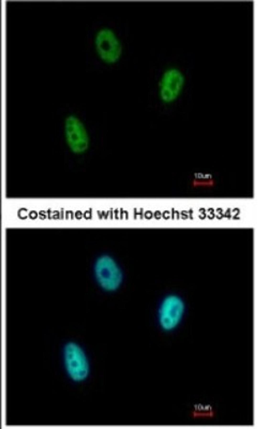 Immunocytochemistry/Immunofluorescence: E2F6 Antibody [NBP2-14936] - Paraformaldehyde-fixed A549, using antibody at 1:500 dilution.