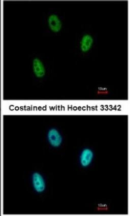 Immunocytochemistry/Immunofluorescence: E2F6 Antibody [NBP2-14936] - Paraformaldehyde-fixed A549, using antibody at 1:500 dilution.