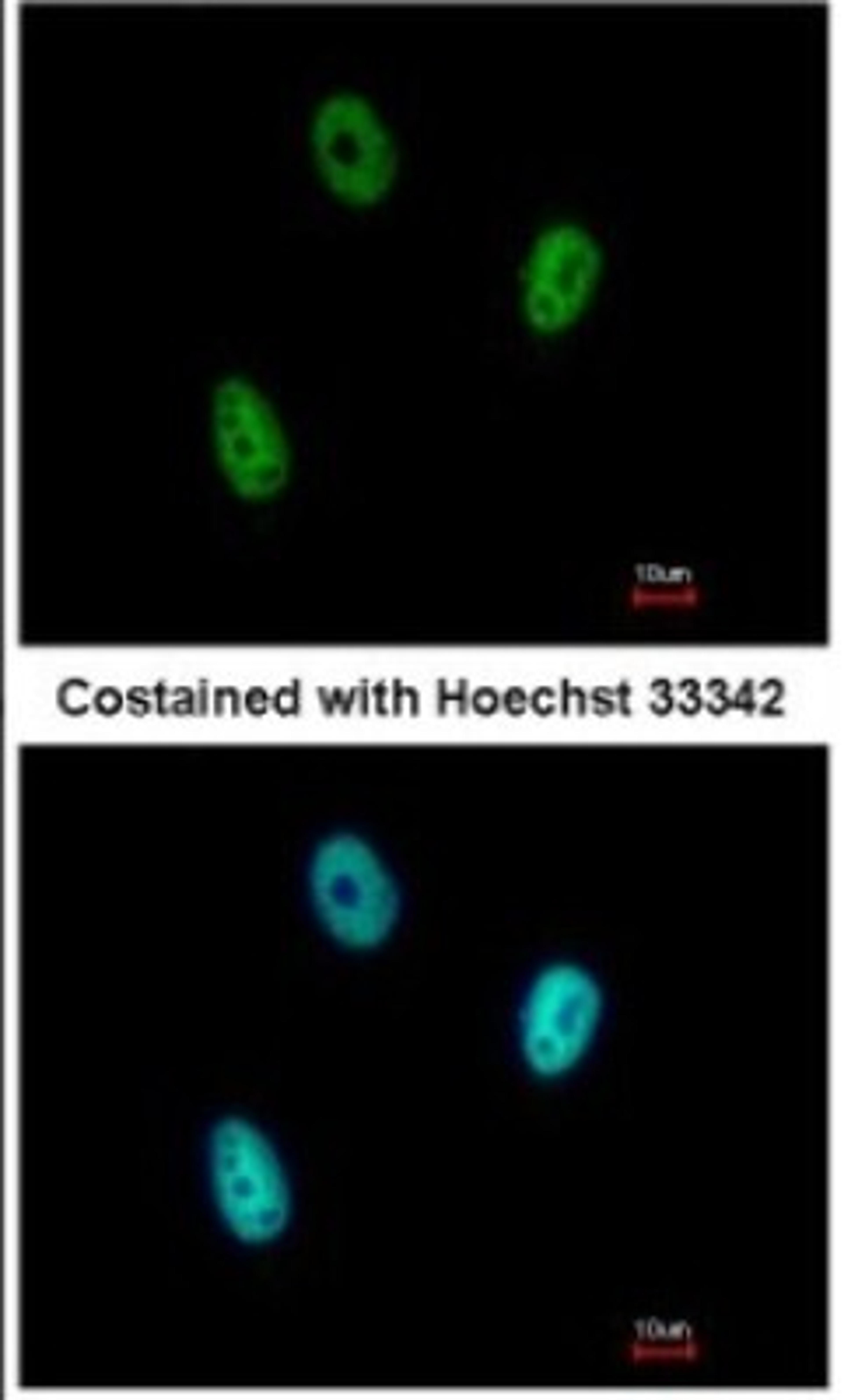 Immunocytochemistry/Immunofluorescence: E2F6 Antibody [NBP2-14936] - Paraformaldehyde-fixed A549, using antibody at 1:500 dilution.