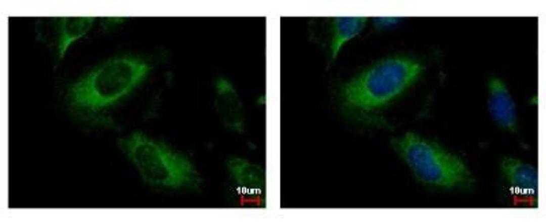 Immunocytochemistry/Immunofluorescence: PP2C alpha/PPM1A Antibody [NBP1-32751] - PPM1A Antibody [NBP1-32751] - Sample: HeLa cells were fixed in 4% paraformaldehyde at RT for 15 min. Green: PPM1A protein stained by PPM1A antibody diluted at 1:500. Blue: Hoechst 33342 staining.