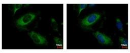 Immunocytochemistry/Immunofluorescence: PP2C alpha/PPM1A Antibody [NBP1-32751] - PPM1A Antibody [NBP1-32751] - Sample: HeLa cells were fixed in 4% paraformaldehyde at RT for 15 min. Green: PPM1A protein stained by PPM1A antibody diluted at 1:500. Blue: Hoechst 33342 staining.