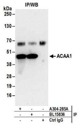 Detection of human ACAA1 by western blot of immunoprecipitates.