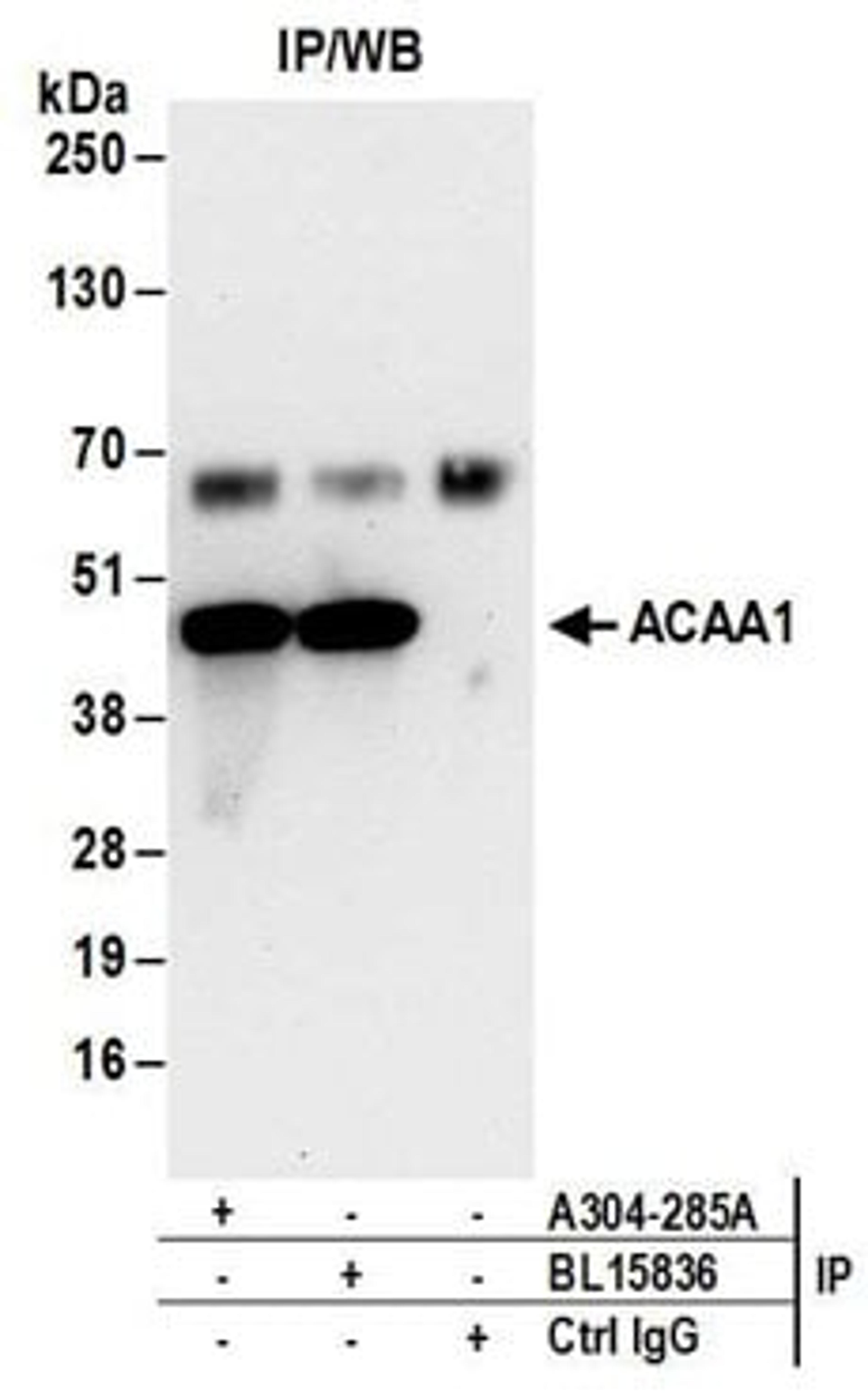 Detection of human ACAA1 by western blot of immunoprecipitates.