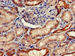 Immunohistochemistry of paraffin-embedded human kidney tissue using CSB-PA008651LA01HU at dilution of 1:100