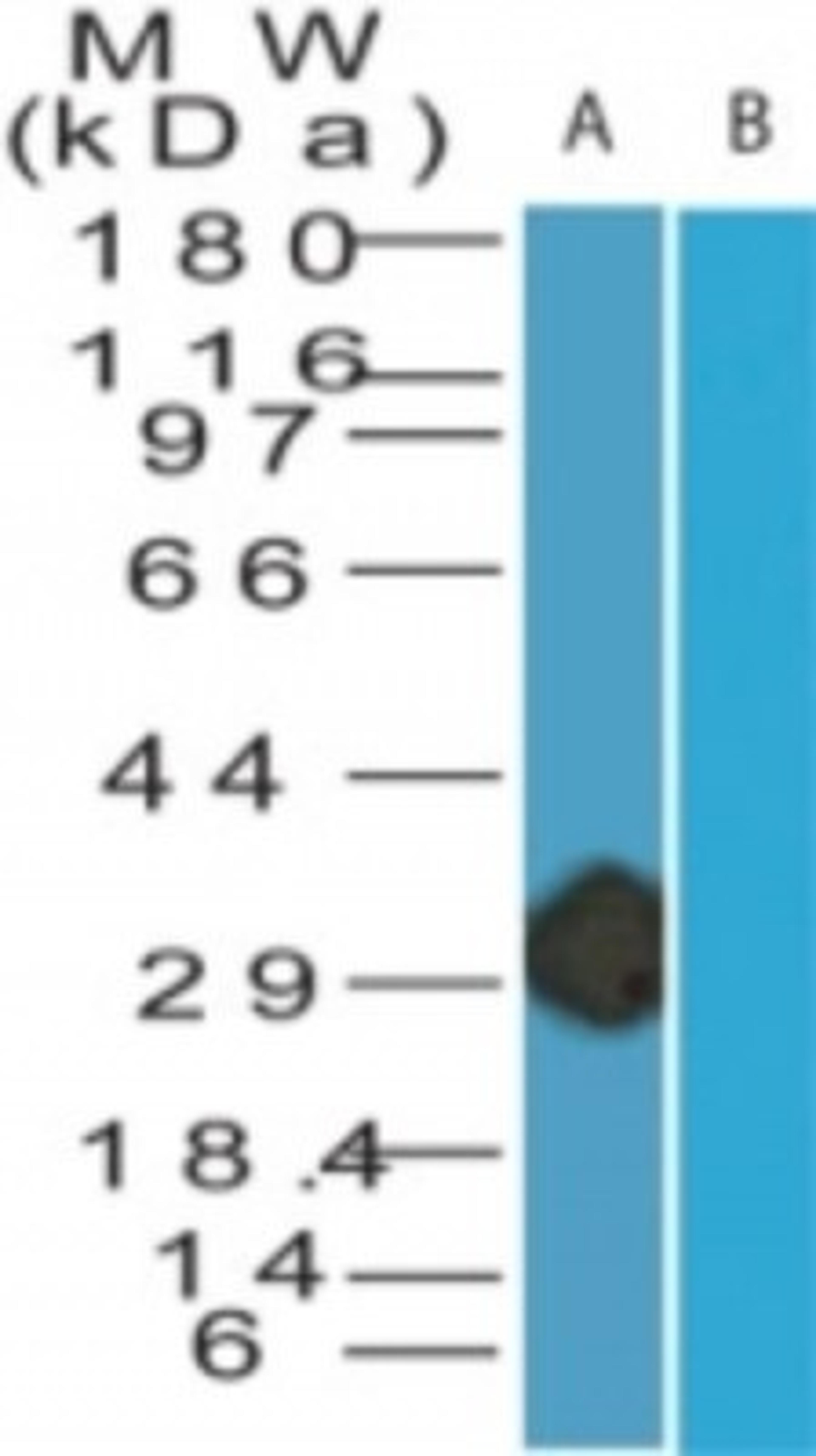 Western Blot: Smallpox B5R Antibody (1J2F3) [NBP2-24699] - Analysis of B5R in (A) recombinant fusion protein containing amino acids 33-47 and (B) fusion partner without these amino acids, using anti-Smallpox antibody at 0.2 ug/ml.