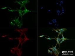 Immunocytochemistry/Immunofluorescence: FAM8A1 Antibody [NBP2-47125] - Hek293 cells were fixed for 5 minute using 10% formalin and then permeabilized for 10 minutes using 1X TBS + 0.5% Triton-X100. The cells were incubated with anti-FAM8A1 at a 1:500 dilution overnight at 4C and detected with an anti-rabbit Dylight 488 (Green) at a 1:500 dilution. Alpha tubulin was used as a co-stain at a 1:1000 dilution and detected with an anti-mouse Dylight 550 (Red) at a 1:500 dilution. Nuclei were counterstained with DAPI (Blue). Cells were imaged using a 40X objective.