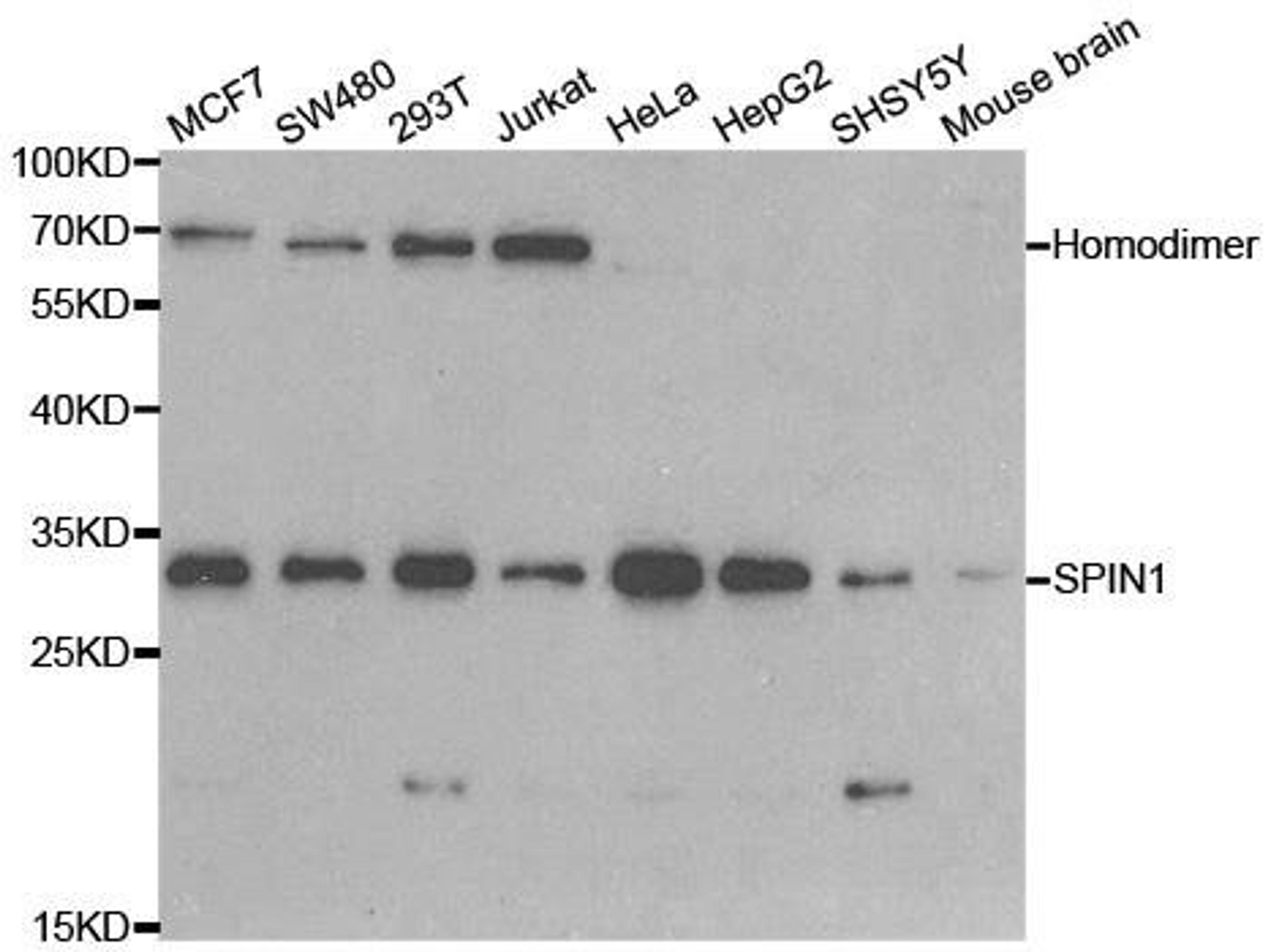 Western blot analysis of extracts of various cell lines using SPIN1 antibody