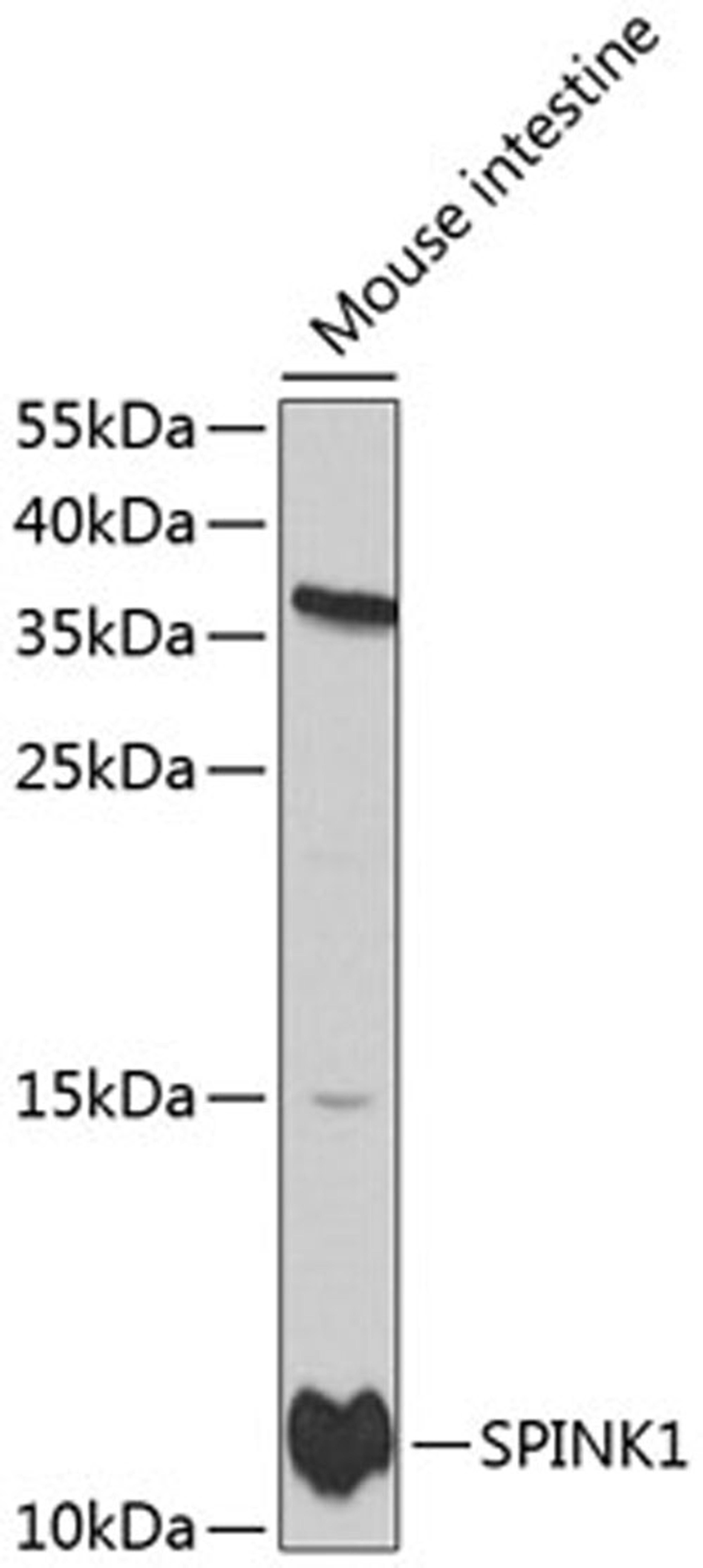 Western blot - SPINK1 antibody (A1096)