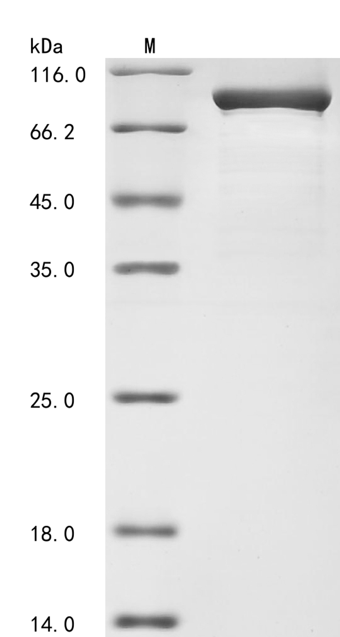 (Tris-Glycine gel) Discontinuous SDS-PAGE (reduced) with 5% enrichment gel and 15% separation gel.