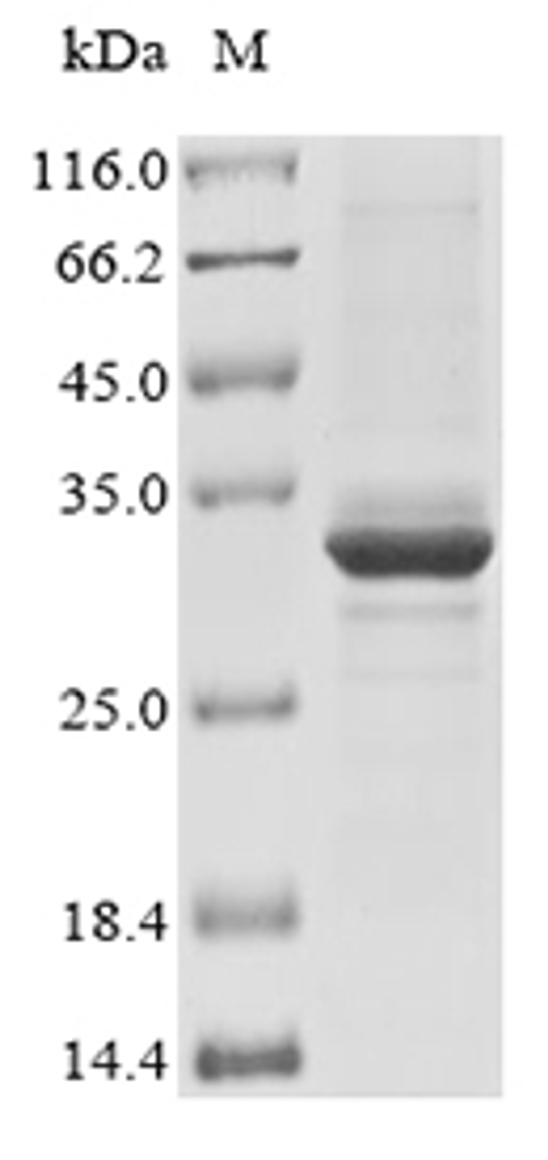 (Tris-Glycine gel) Discontinuous SDS-PAGE (reduced) with 5% enrichment gel and 15% separation gel.