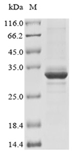 (Tris-Glycine gel) Discontinuous SDS-PAGE (reduced) with 5% enrichment gel and 15% separation gel.