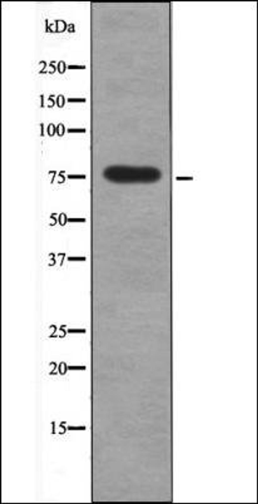 Western blot analysis of UV treated 293 whole cell lysates using PKCD -Phospho-Ser664- antibody