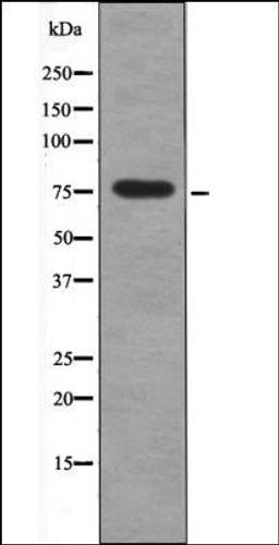 Western blot analysis of UV treated 293 whole cell lysates using PKCD -Phospho-Ser664- antibody