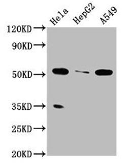 Western Blot. Positive WB detected in: Hela whole cell lysate, HepG2 whole cell lysate, A549 whole cell lysate. All lanes: MSS51 antibody at 4µg/ml. Secondary. Goat polyclonal to rabbit IgG at 1/50000 dilution. Predicted band size: 52, 27, 11 kDa. Observed band size: 52 kDa