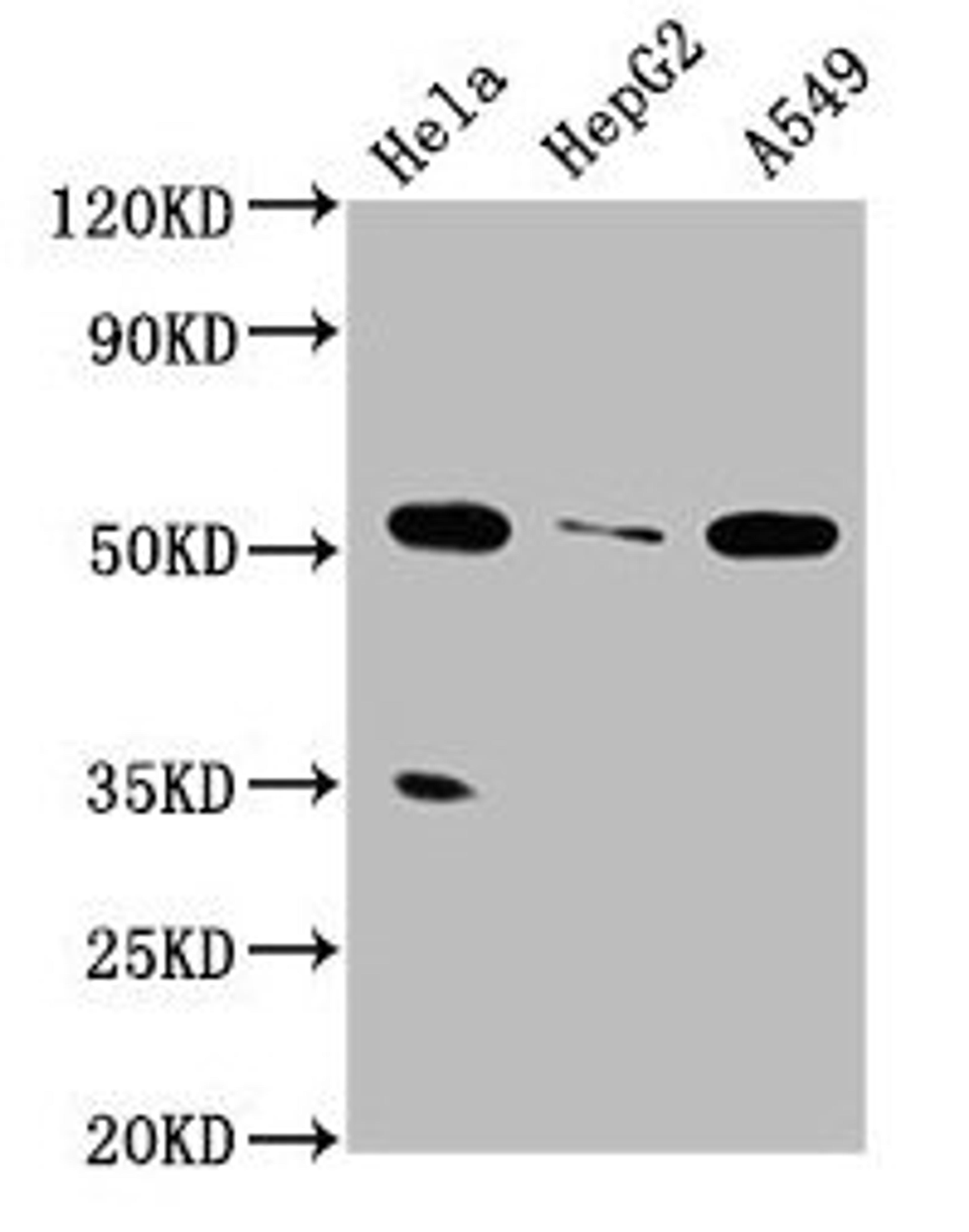 Western Blot. Positive WB detected in: Hela whole cell lysate, HepG2 whole cell lysate, A549 whole cell lysate. All lanes: MSS51 antibody at 4µg/ml. Secondary. Goat polyclonal to rabbit IgG at 1/50000 dilution. Predicted band size: 52, 27, 11 kDa. Observed band size: 52 kDa