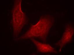 Immunocytochemistry/Immunofluorescence: NFkB p65 [p Ser311] Antibody [NB100-82080] - Staining of methanol-fixed HeLa cells using NFkB-p65 (phospho-Ser311) antibody.