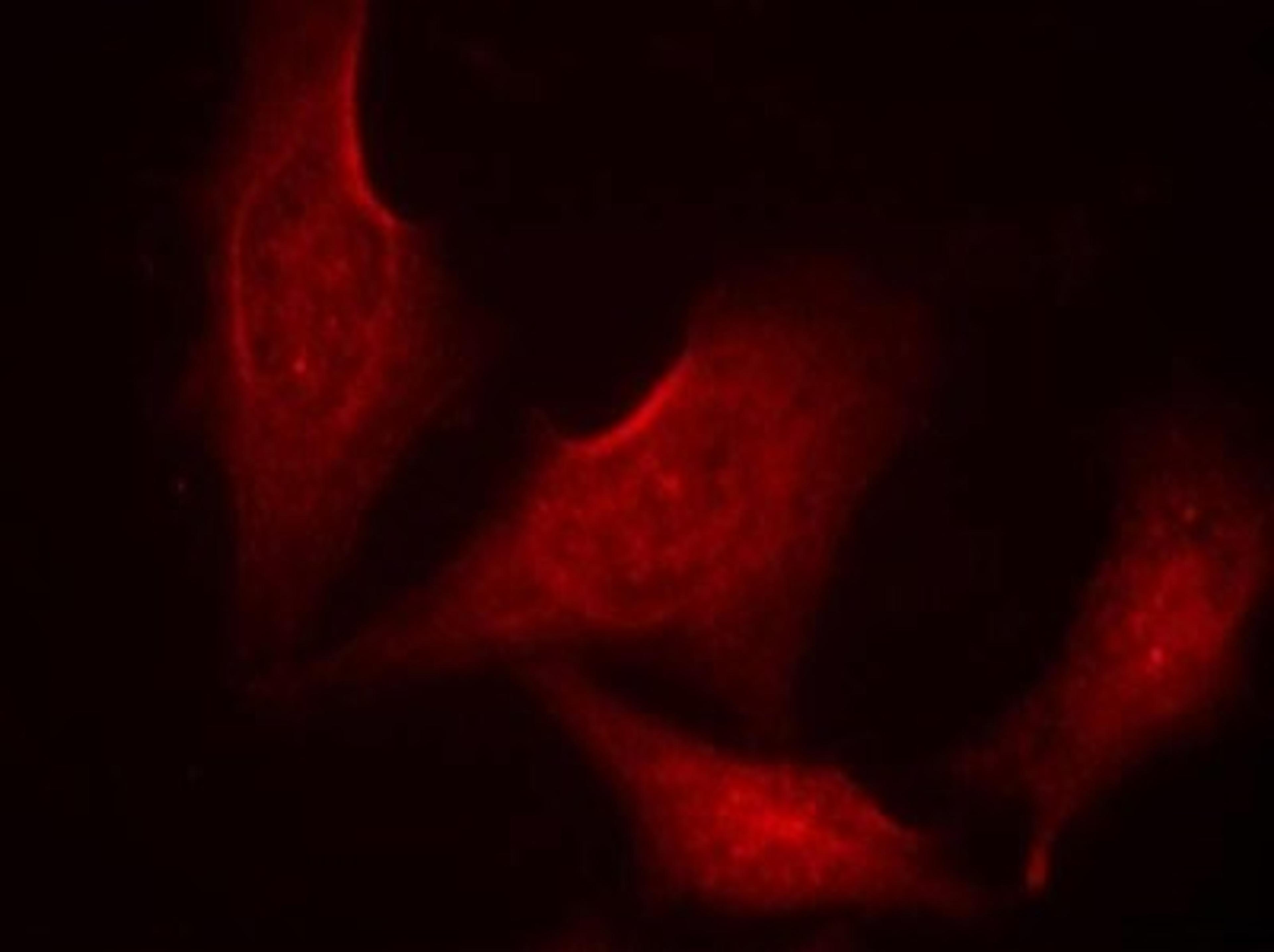 Immunocytochemistry/Immunofluorescence: NFkB p65 [p Ser311] Antibody [NB100-82080] - Staining of methanol-fixed HeLa cells using NFkB-p65 (phospho-Ser311) antibody.