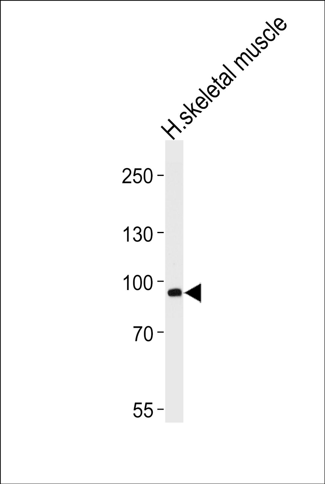 Western blot analysis of lysate from human skeletal muscle tissue lysate, using PFKM Antibody (S137) at 1:1000 at each lane.