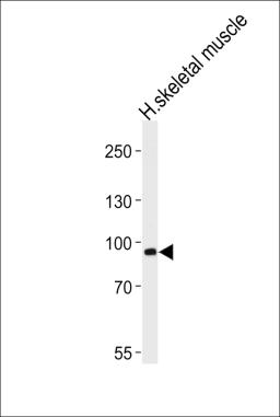 Western blot analysis of lysate from human skeletal muscle tissue lysate, using PFKM Antibody (S137) at 1:1000 at each lane.