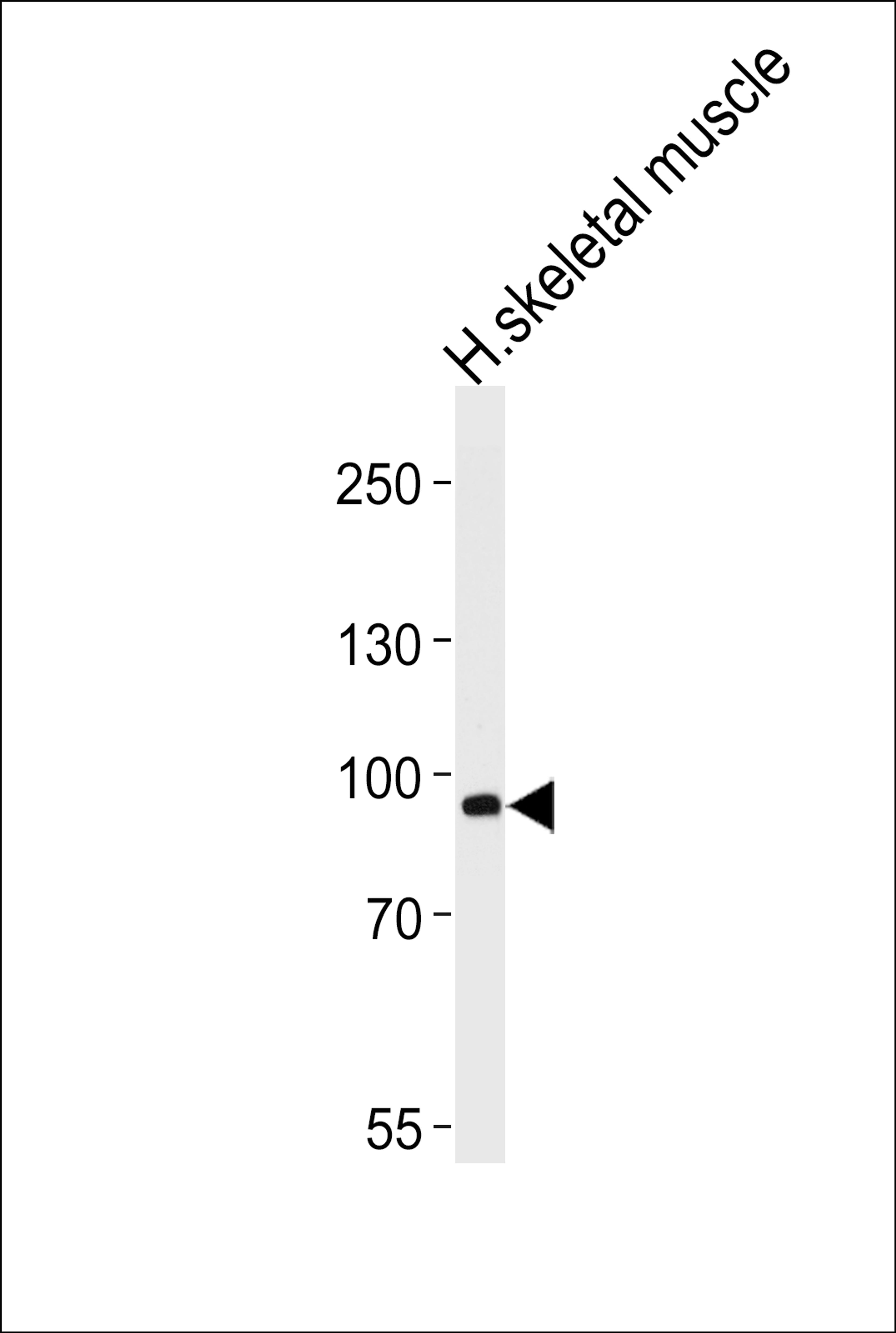 Western blot analysis of lysate from human skeletal muscle tissue lysate, using PFKM Antibody (S137) at 1:1000 at each lane.