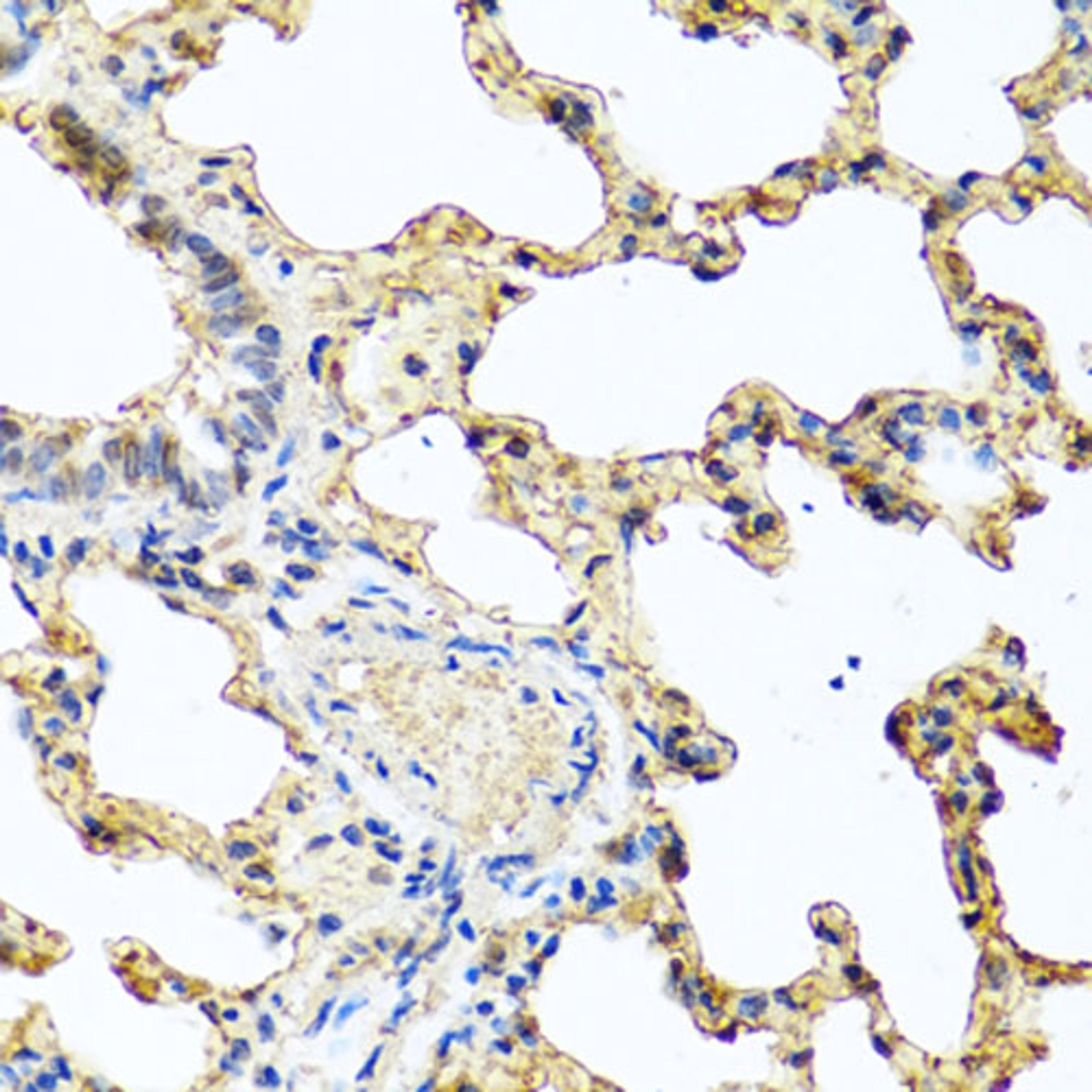 Immunohistochemistry - PIP antibody (A6394)
