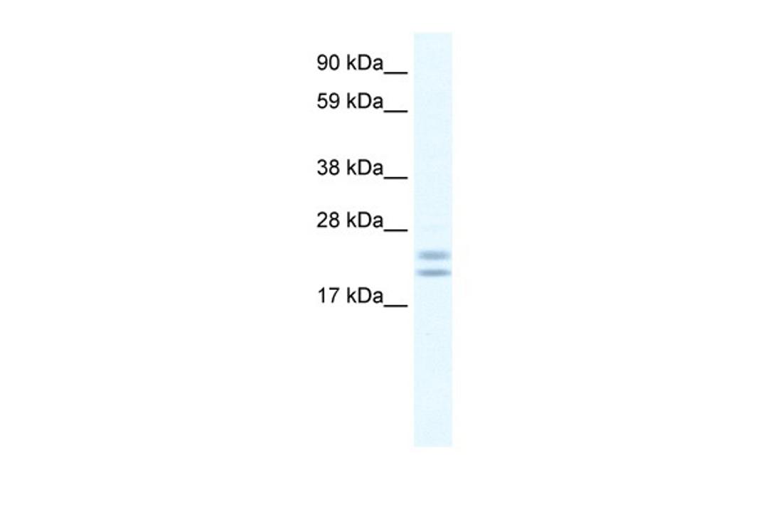 Antibody used in WB on Human Frontal Cortex at 0.625 ug/ml.