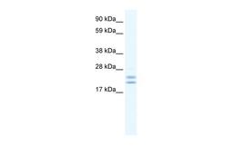 Antibody used in WB on Human Frontal Cortex at 0.625 ug/ml.