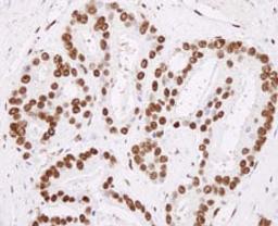 Detection of human hnRNP-H by immunohistochemistry.