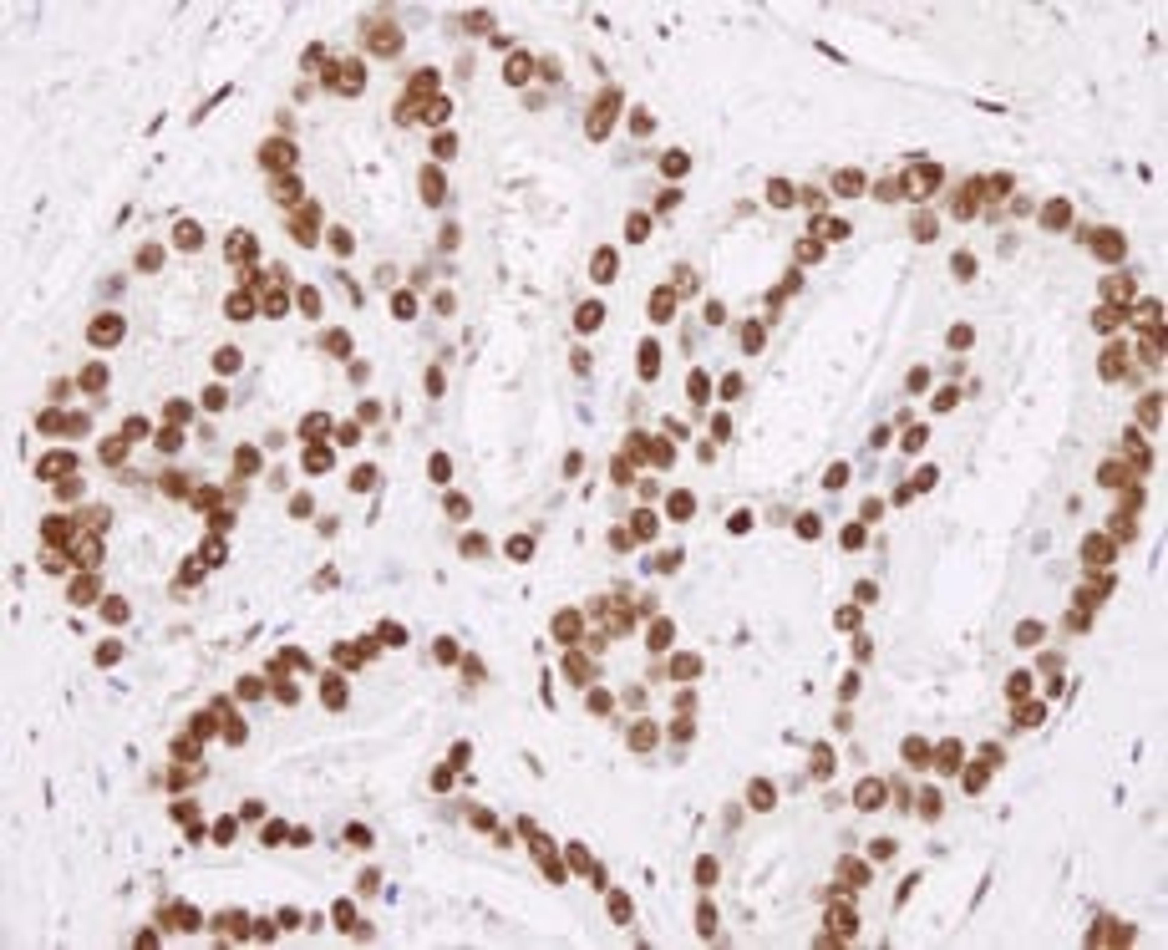 Detection of human hnRNP-H by immunohistochemistry.