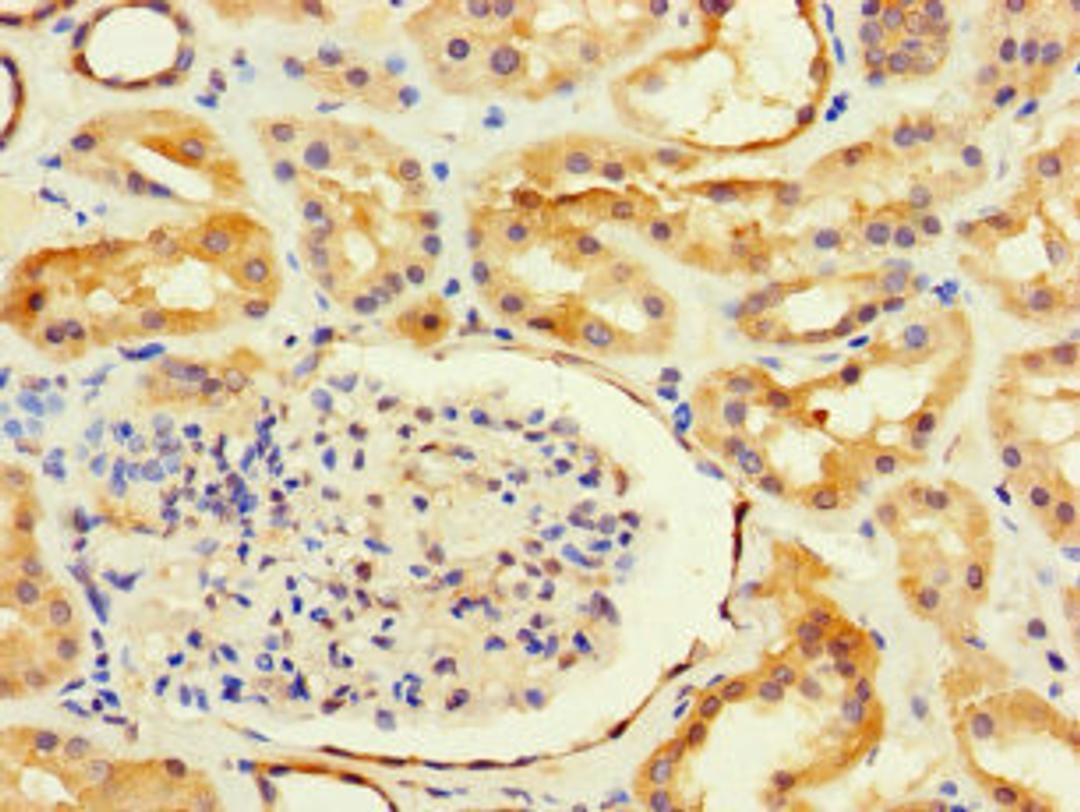 Immunohistochemistry of paraffin-embedded human kidney tissue using CSB-PA660753LA01HU at dilution of 1:100