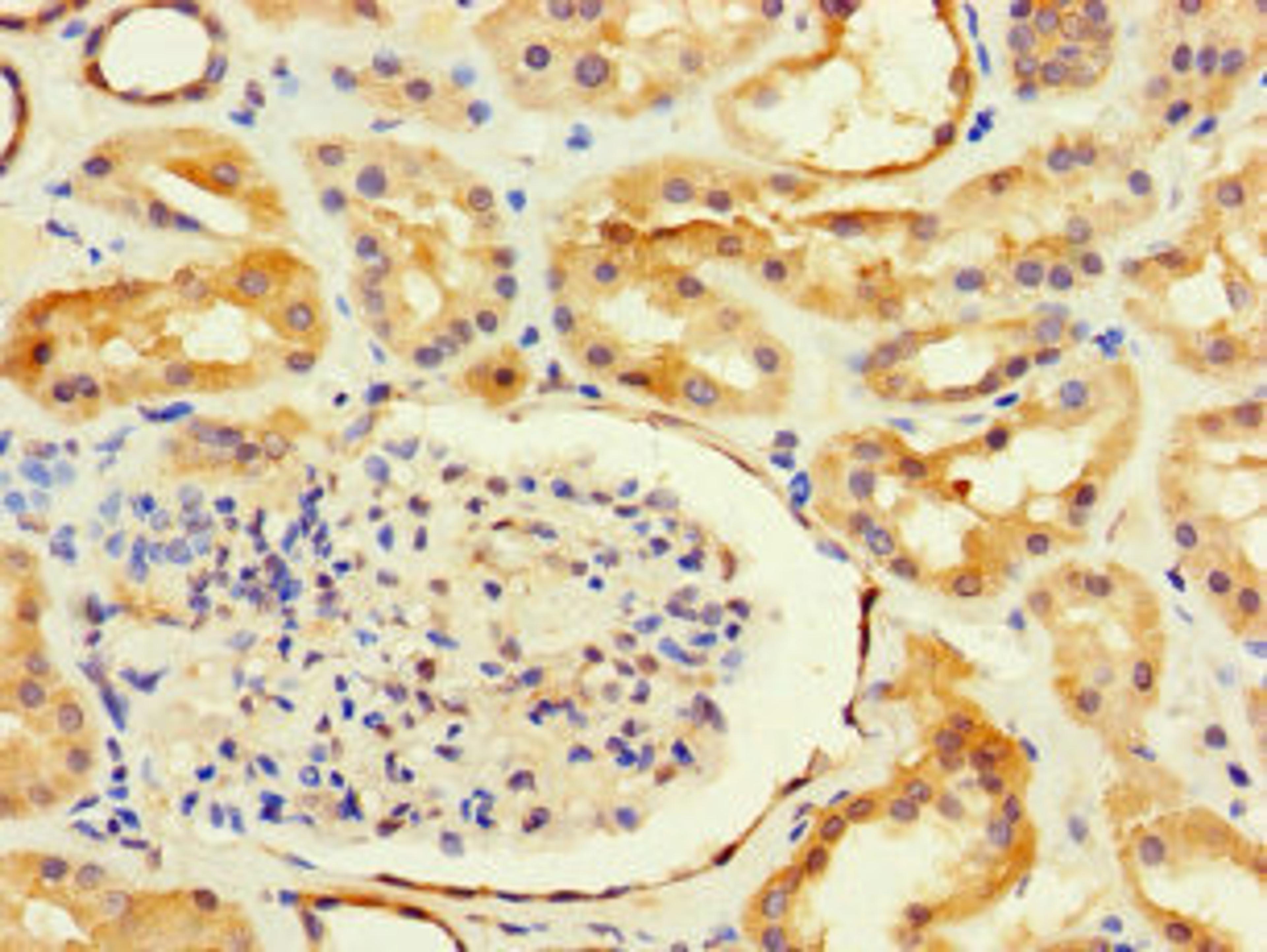 Immunohistochemistry of paraffin-embedded human kidney tissue using CSB-PA660753LA01HU at dilution of 1:100