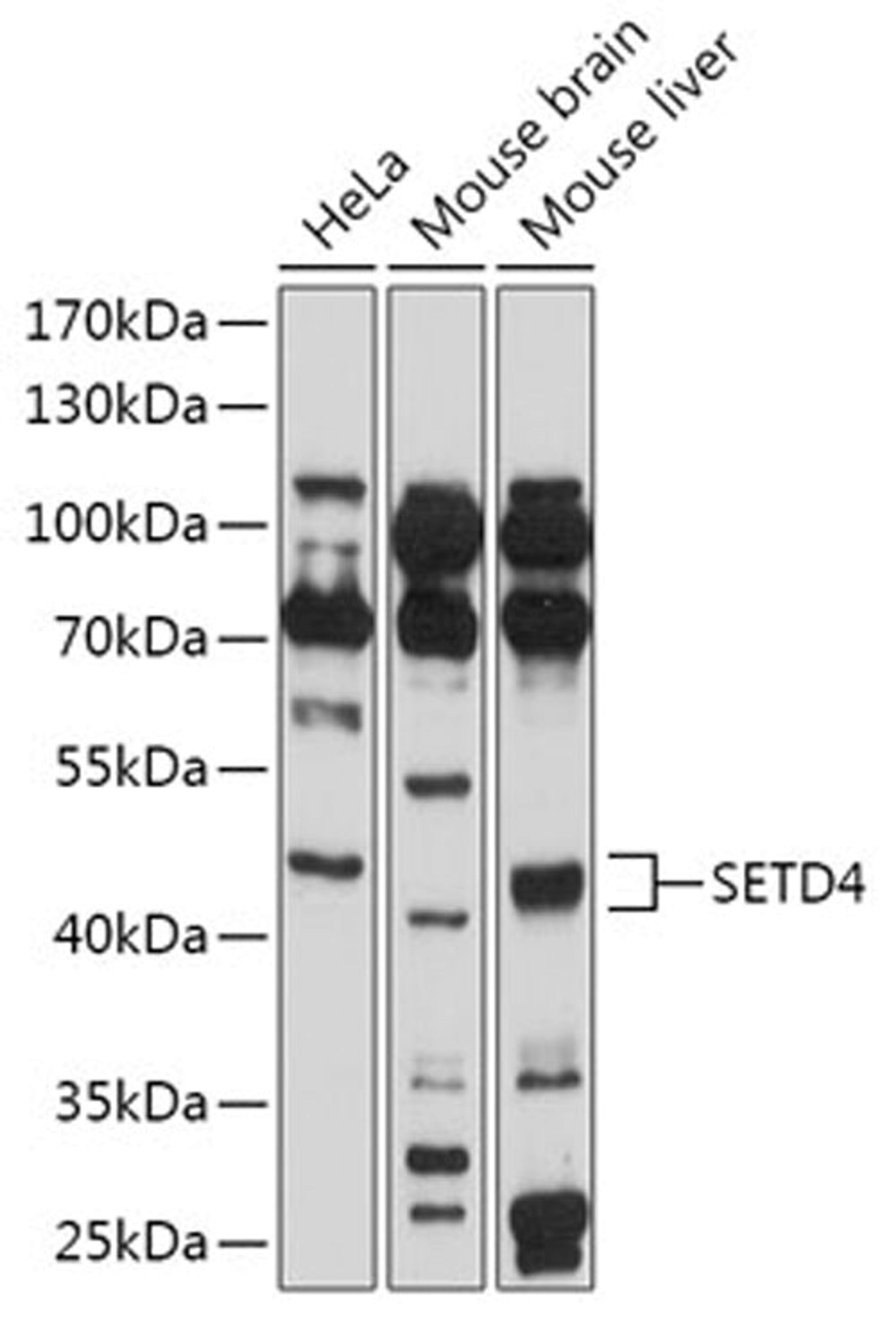 Western blot - SETD4 antibody (A17708)