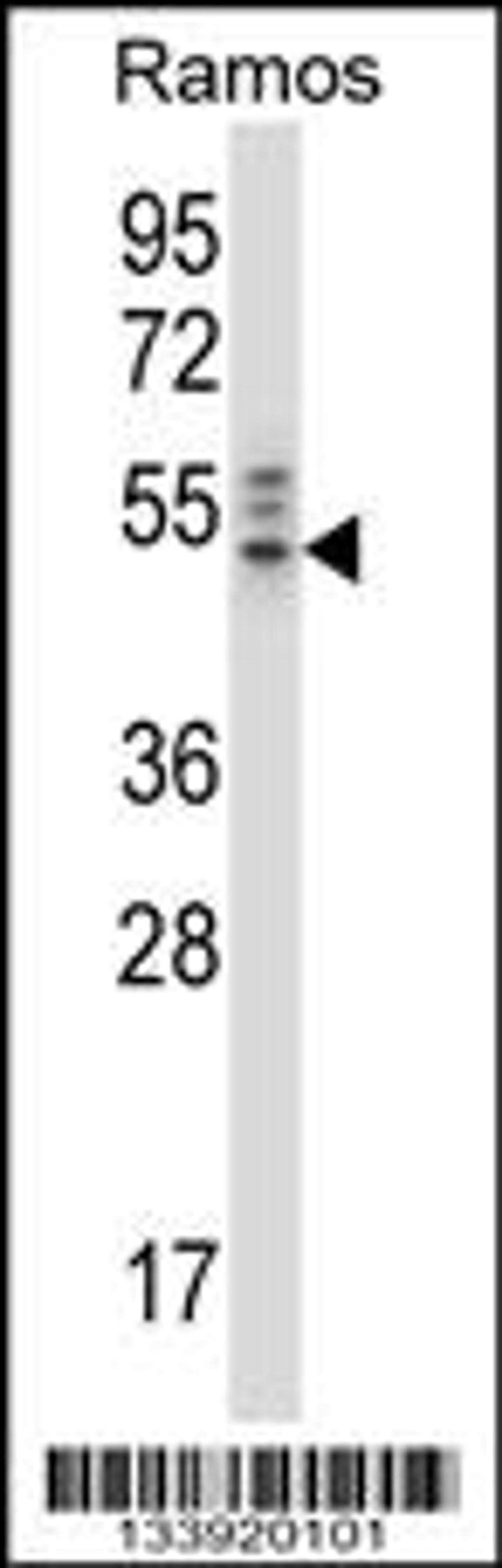 Western blot analysis in Ramos cell line lysates (35ug/lane).