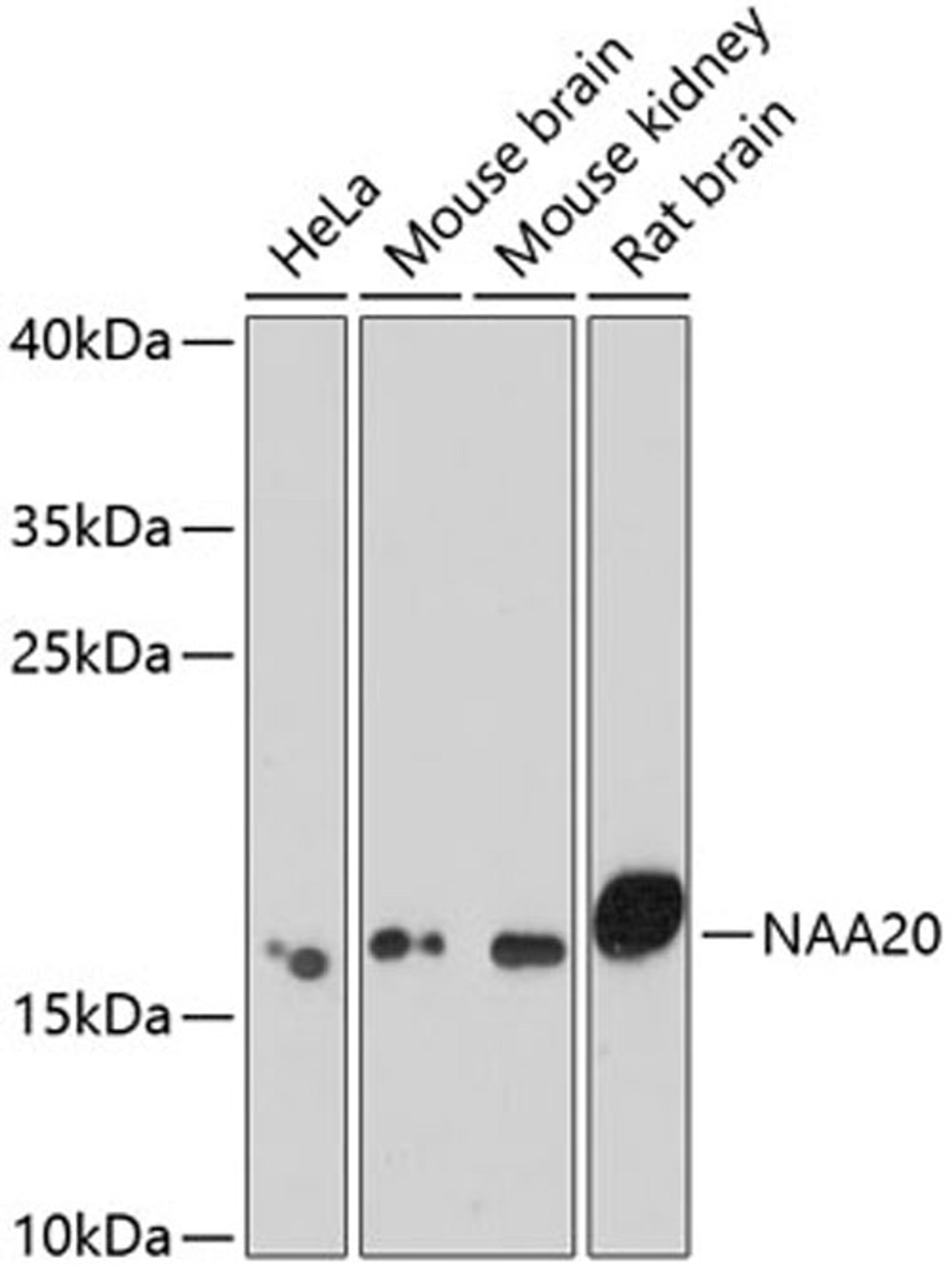 Western blot - NAA20 antibody (A7105)